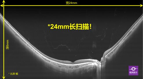 圖湃醫(yī)療亮相2021中國眼底病論壇 24mm血流成像技術引領眼底診斷新高度